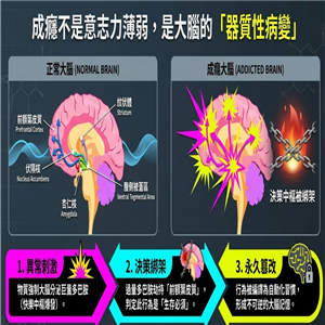 大腦成癮示意圖(AI優化)